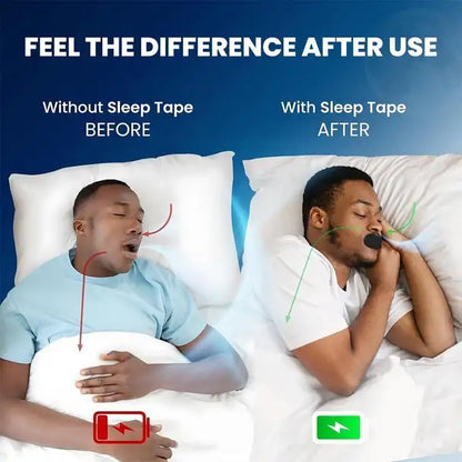 Mouth Tape for Better Sleep – Hypoallergenic, Skin-Safe, Comfortable Anti-snoring Device (Mouthpiece)